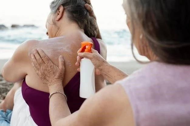 Remedios Caseros para Aliviar las Quemaduras Solares